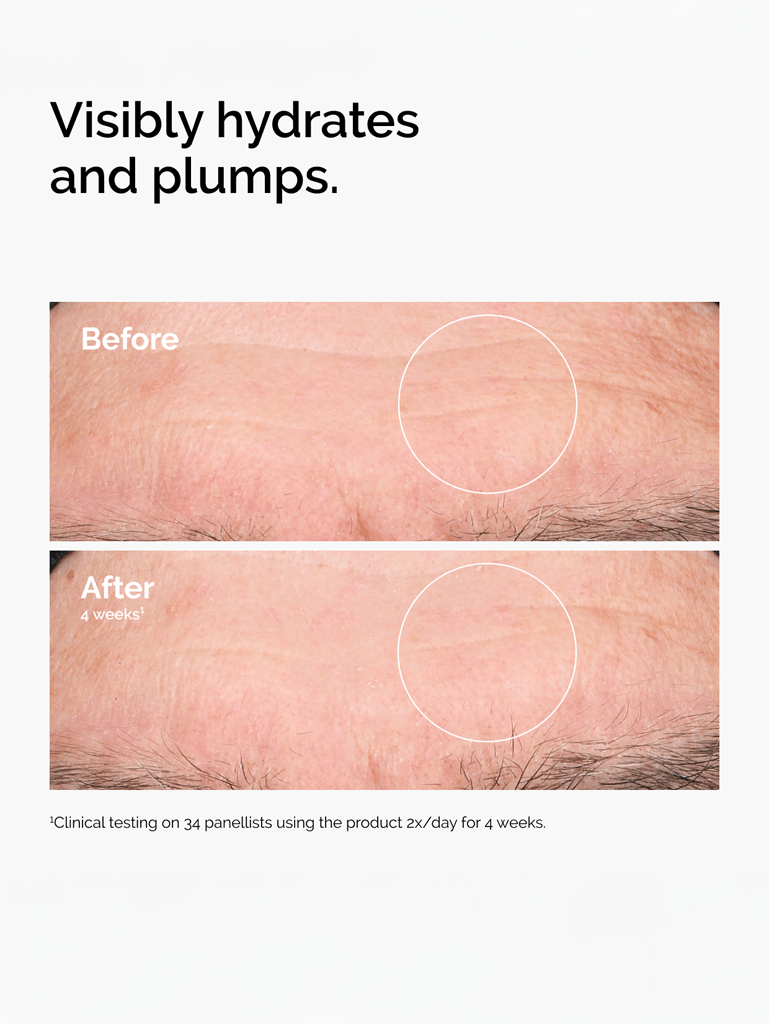 Acide hyaluronique 2% + b5 v2 | The Ordinary 5