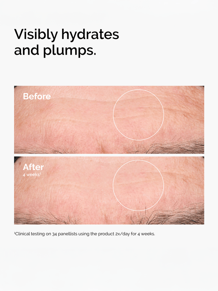 Acide hyaluronique 2% + b5 v2 | The Ordinary 5