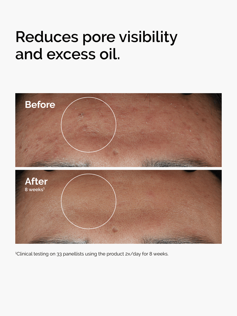Niacinamide 10% + zinc 1% | The Ordinary 3