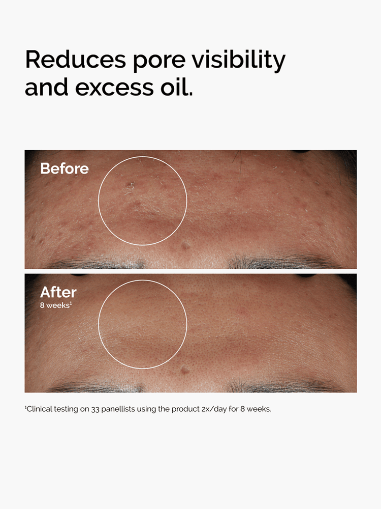 Niacinamide 10% + zinc 1% | The Ordinary 3