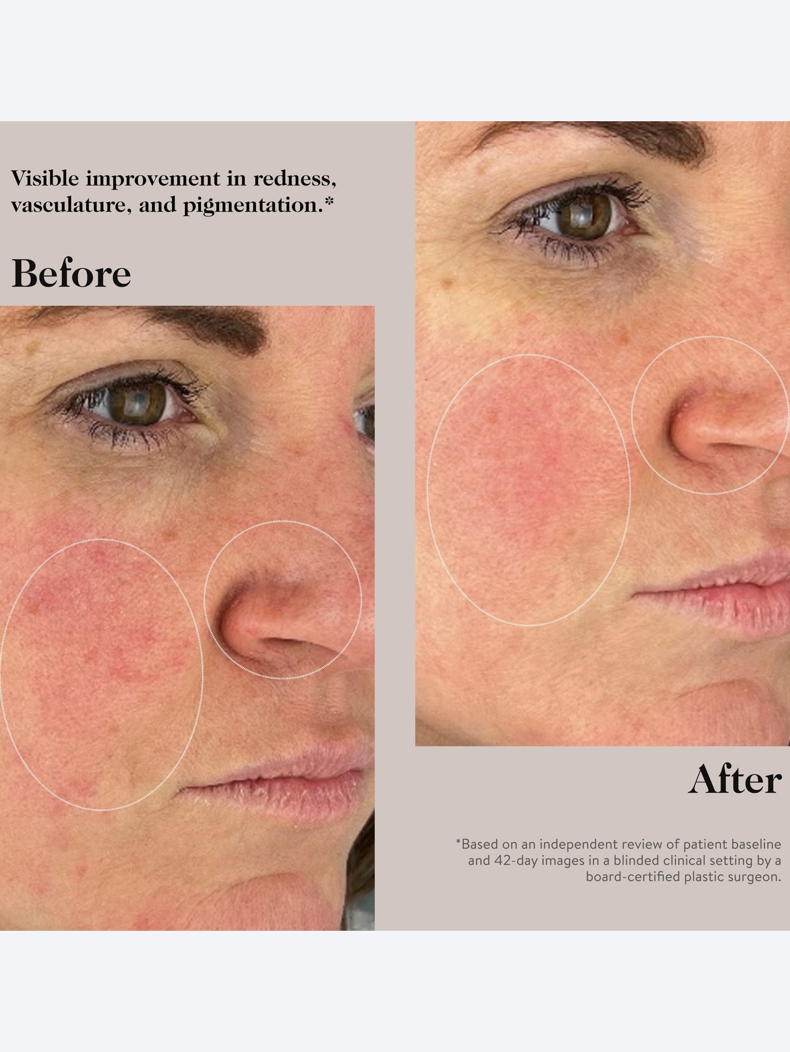Peptidserum für ein jugendliches Aussehen 5