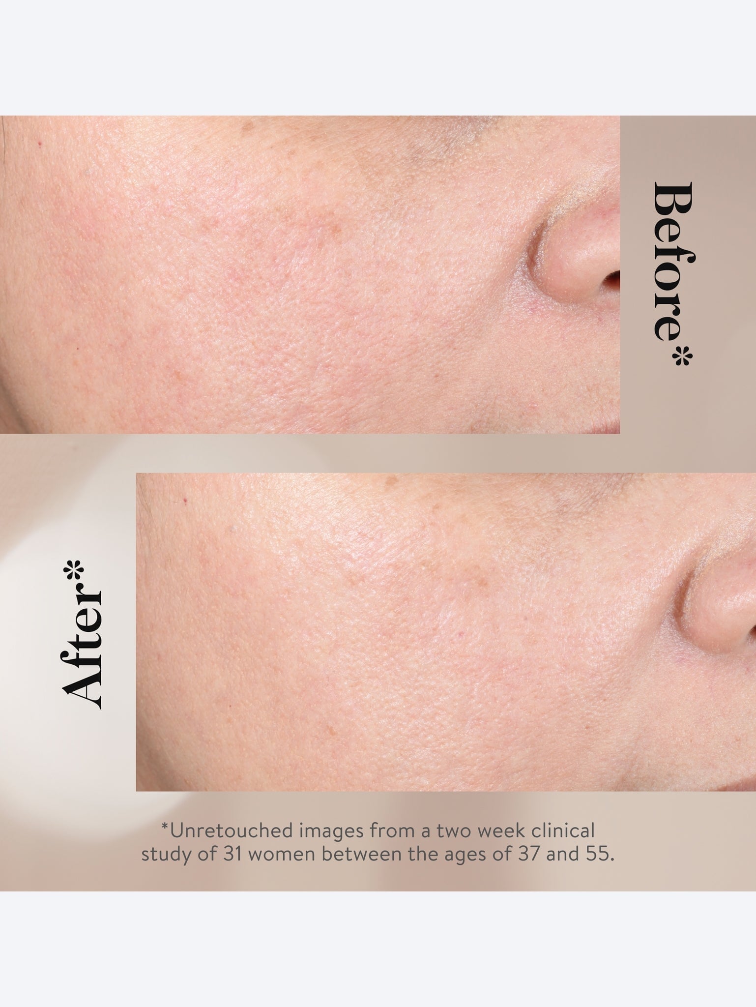 15% glycolic acid overnight glowpee 7