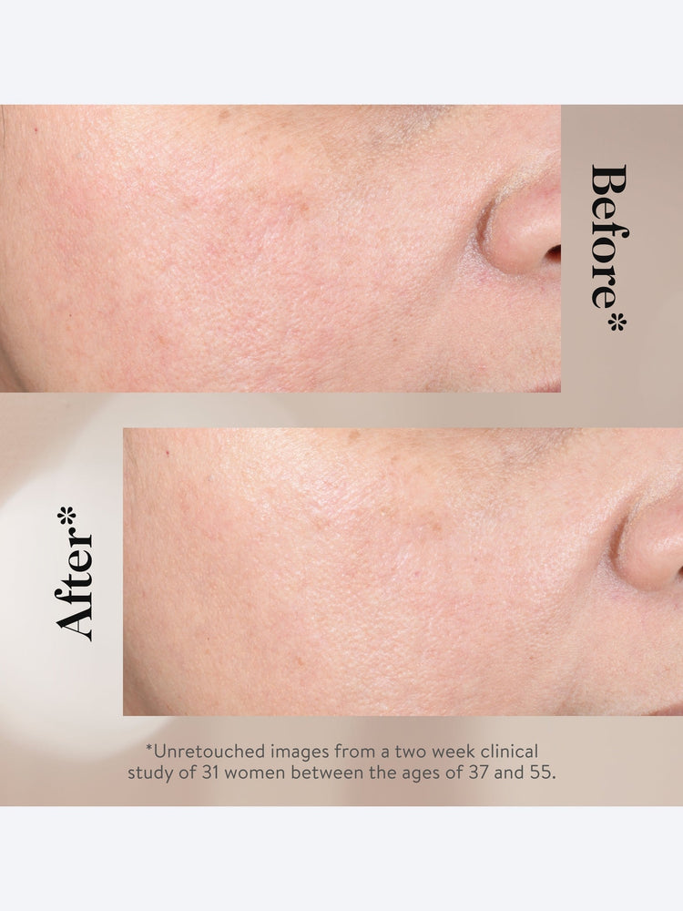 15% glycolic acid overnight glowpee 7