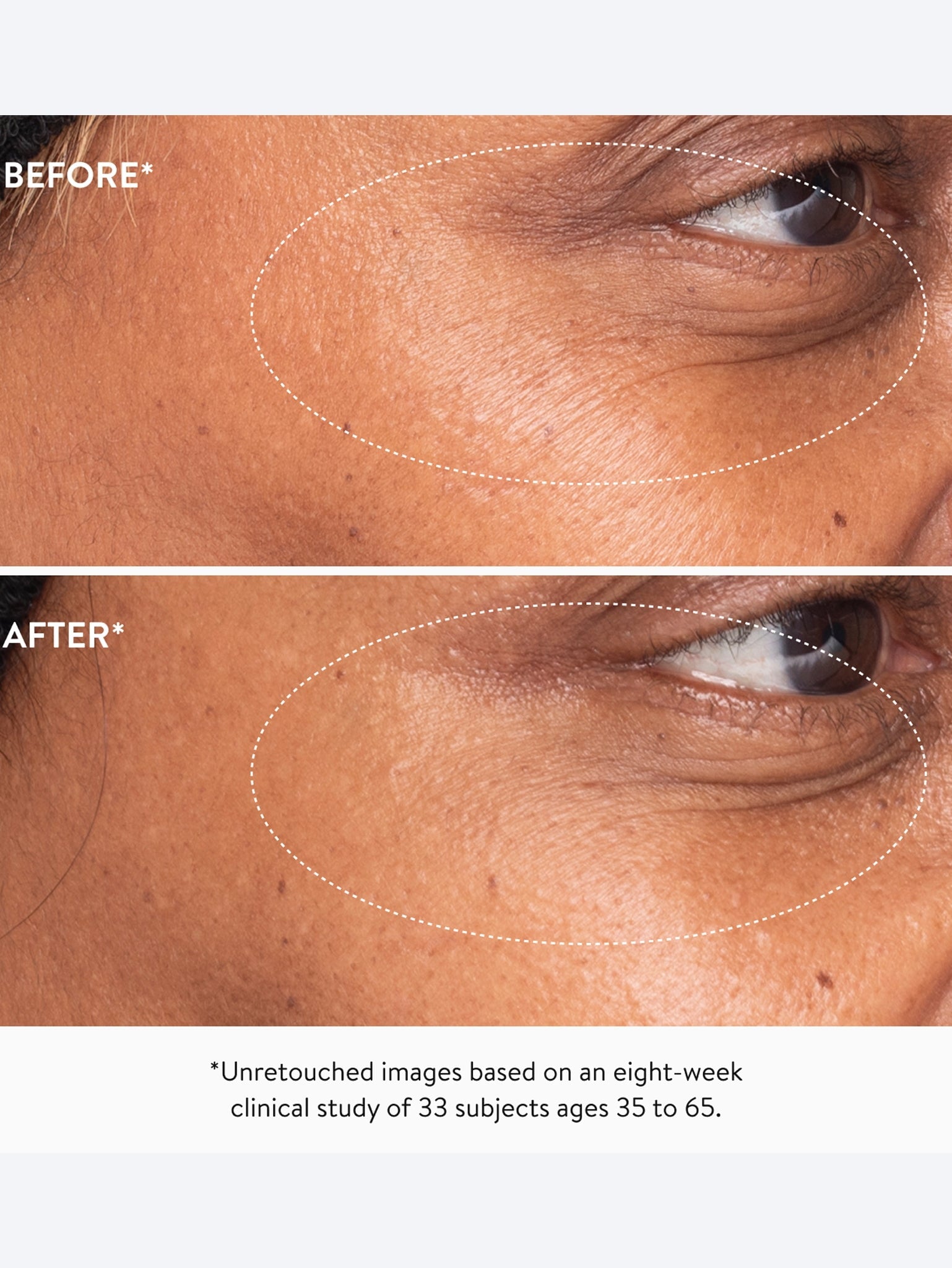 3x retinol eye lift serum 8