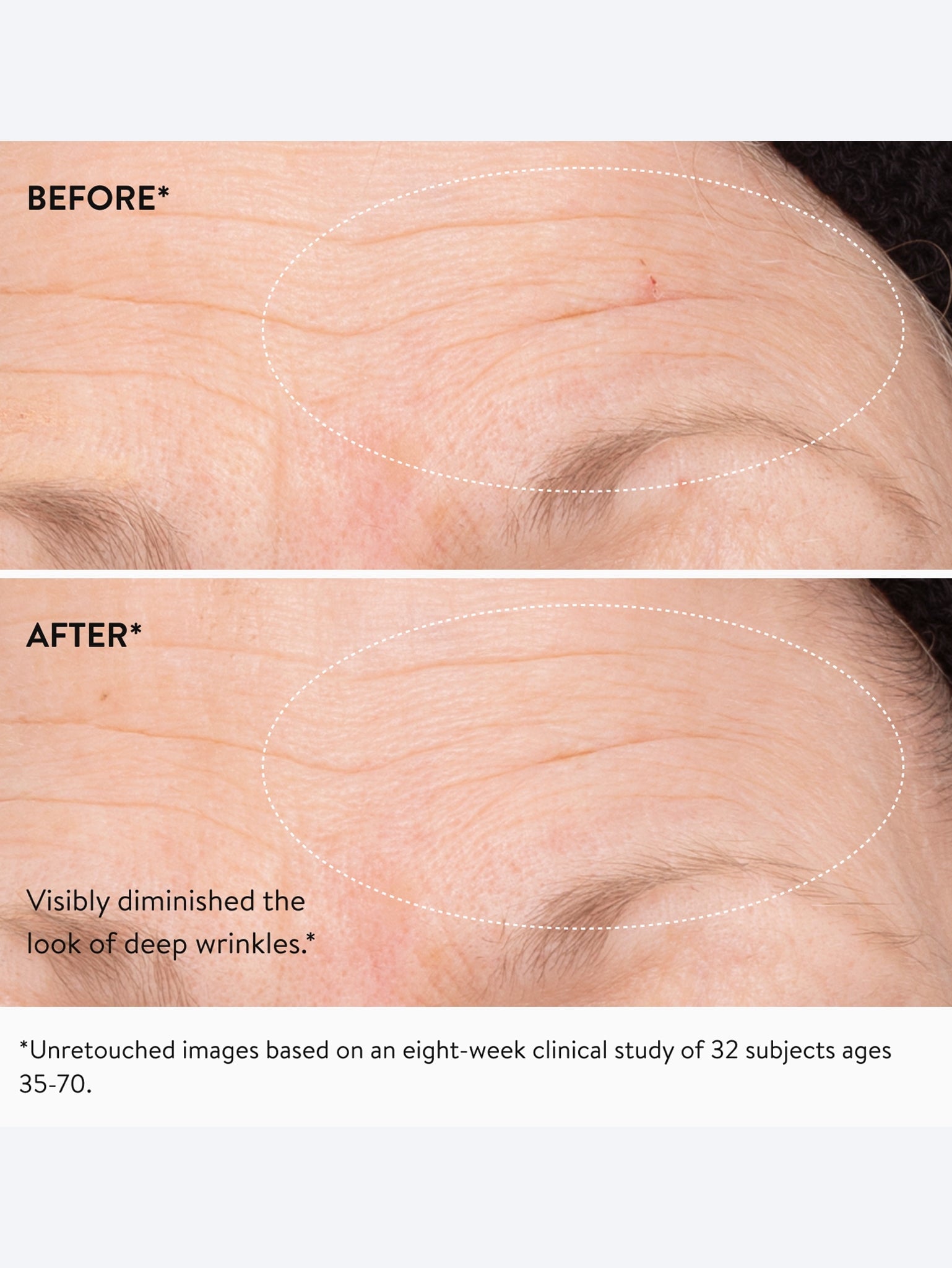3x retinol regenerative serum 10