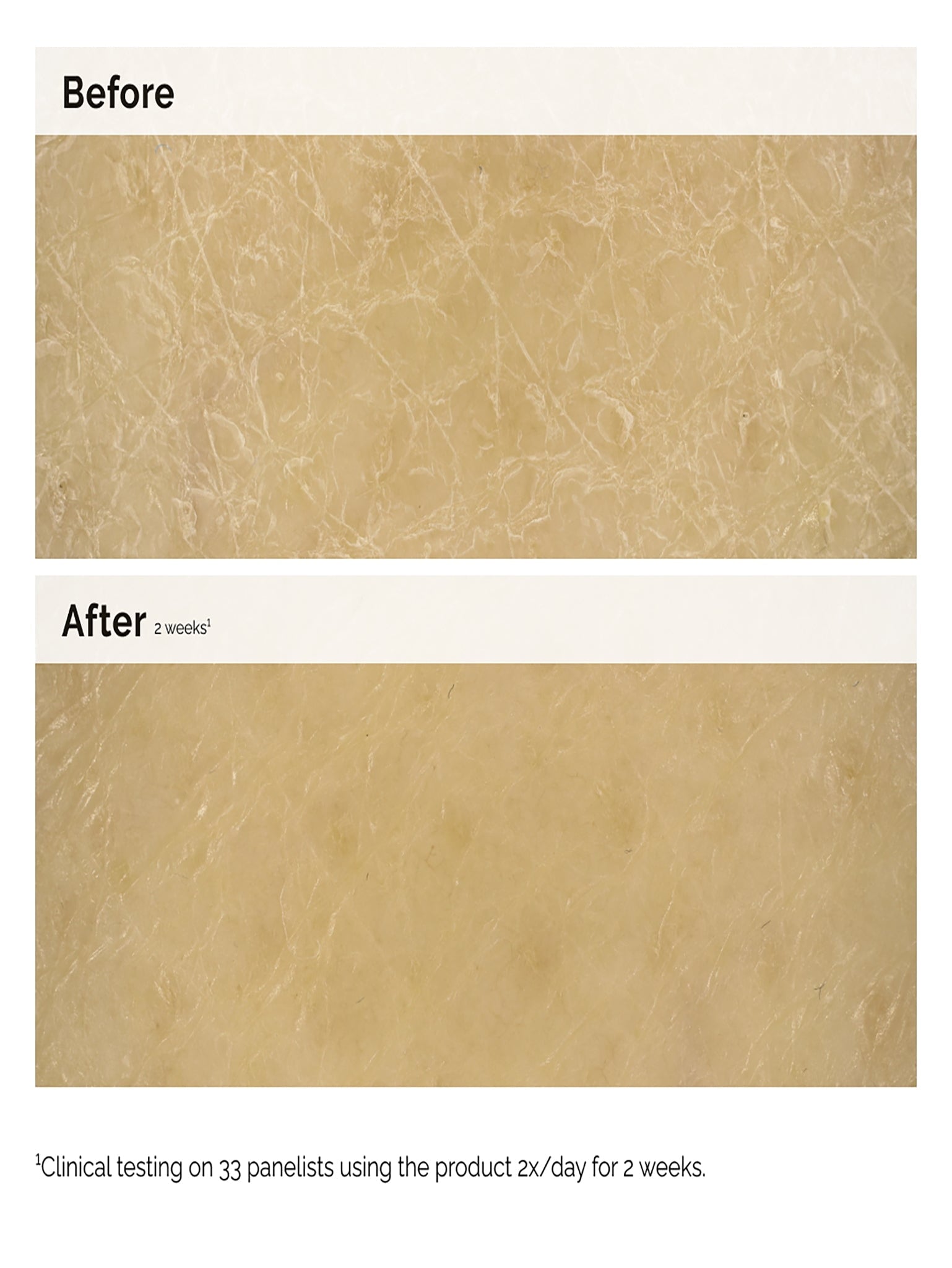 Facteurs hydratants naturels + inul 4