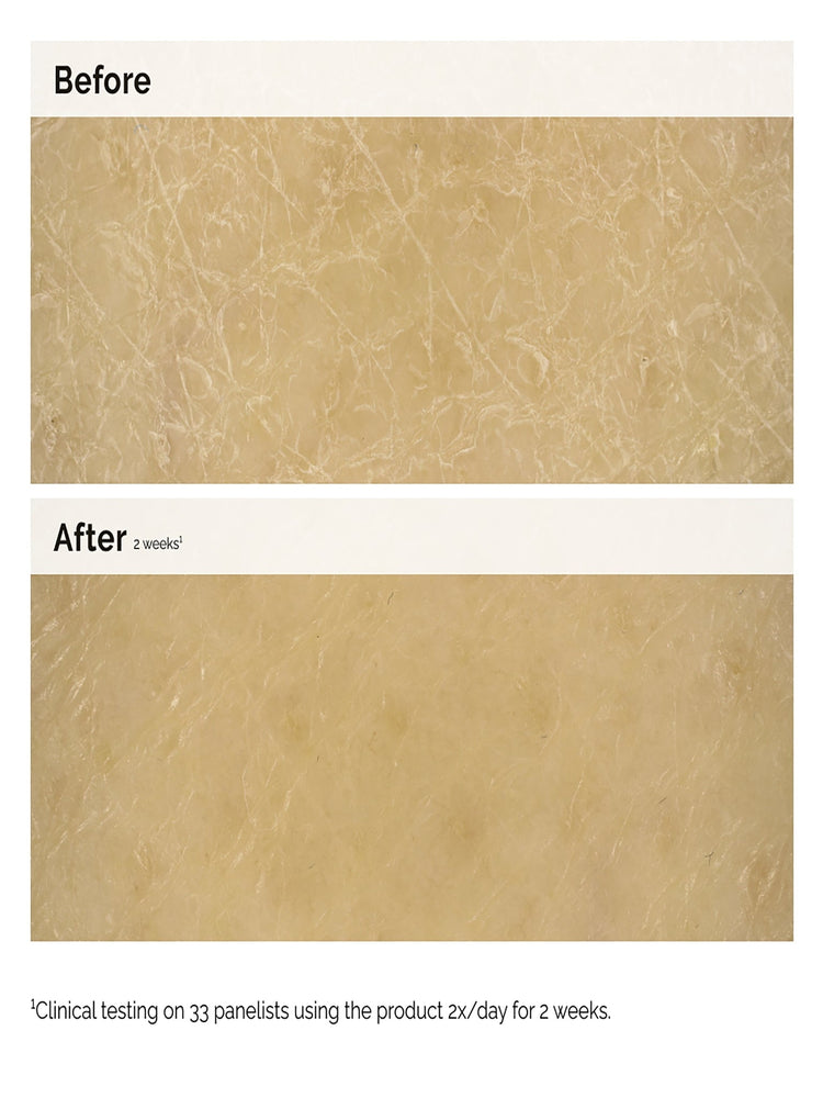 Facteurs hydratants naturels + inul 4