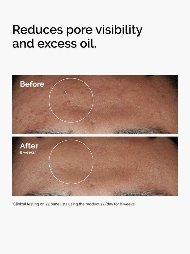 Niacinamide 10% + zinc 1% 60ml 3