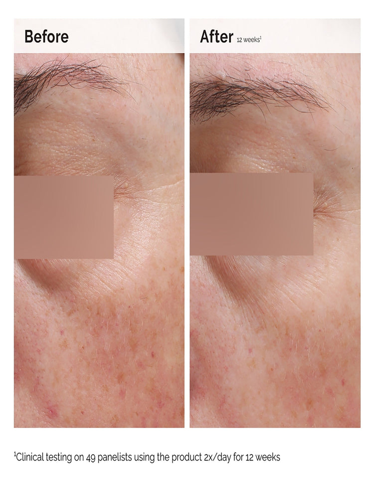 Niacinamid 5 % Gesichts- und Körperemulsion 100 ml | das Gewöhnliche 4