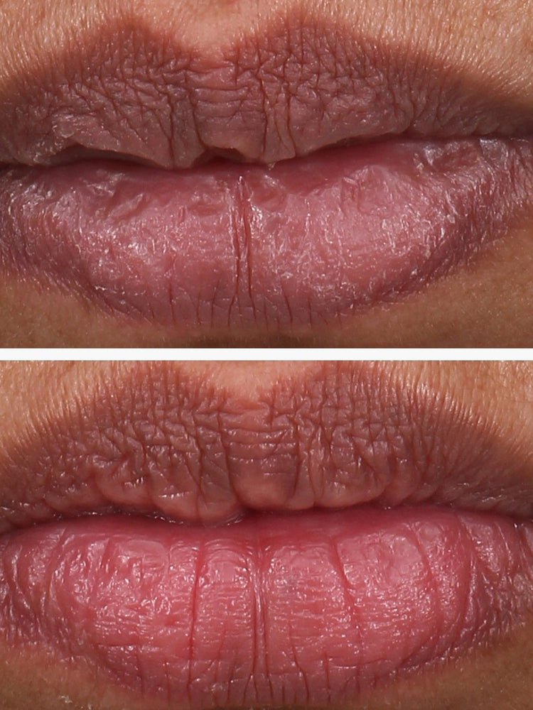 Pha 5% exfoliating lip serum 15ml 4